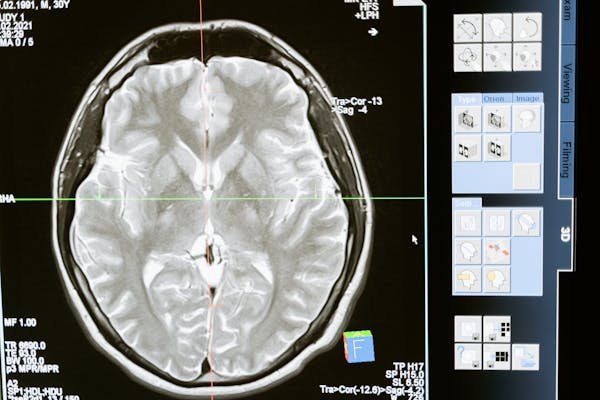 AI algorithms are only as good as the data they are trained on. If the training data contains biases, the AI models may produce biased outcomes, leading to unfair treatment.